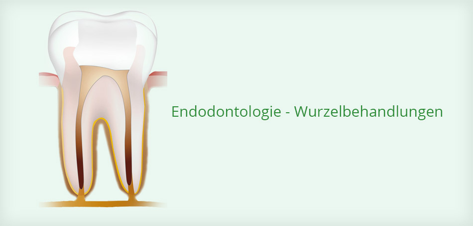 Endodontologie Wurzelbehandlungen